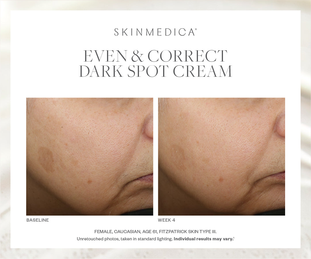 SkinMedica Even & Correct Dark Spot Cream (0.5 oz)