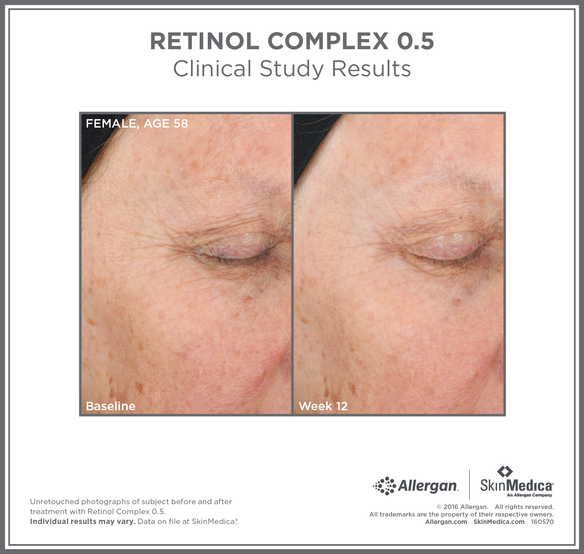SkinMedica Retinol Complex 0.5 (1 oz)