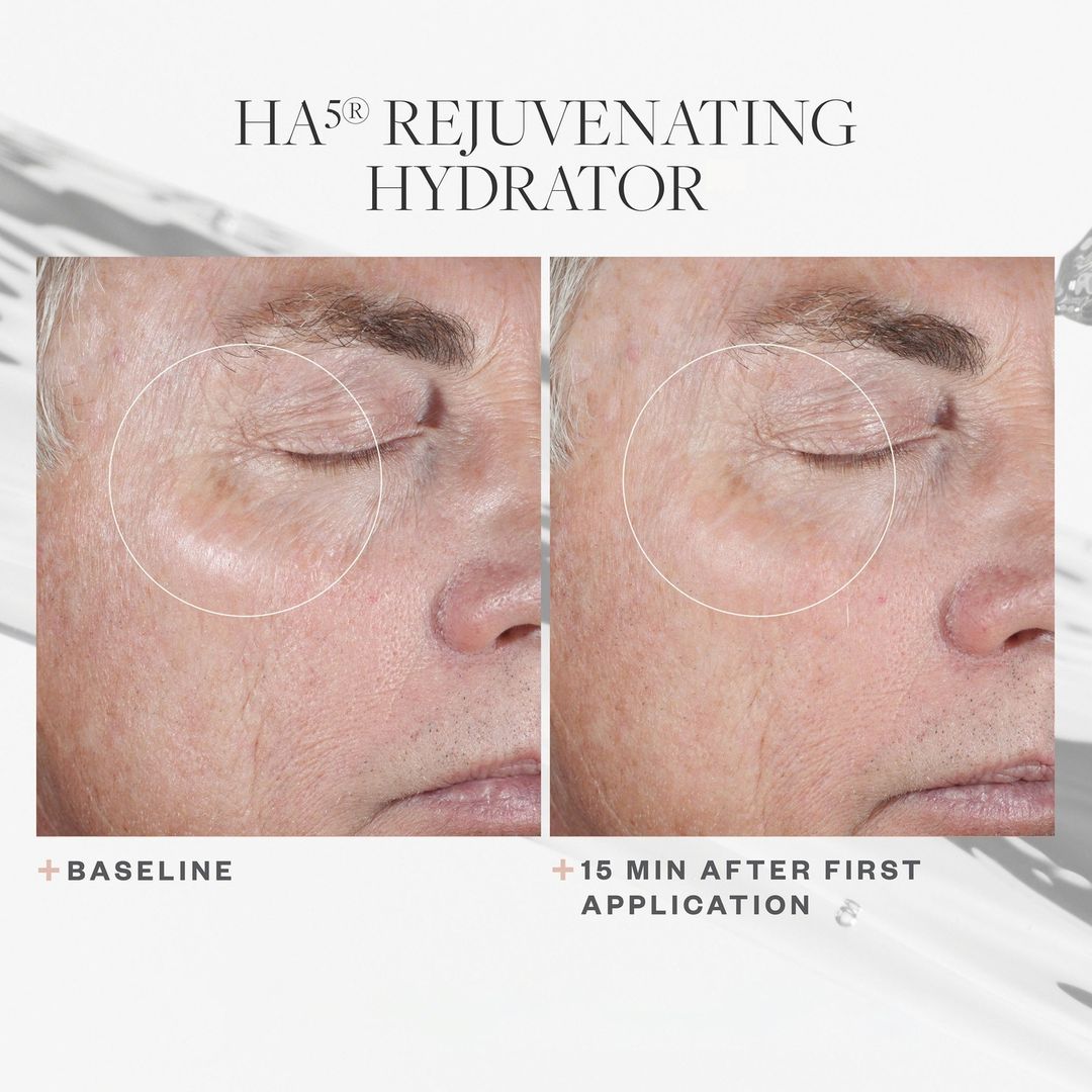 SkinMedica HA5 Rejuvenating Hydrator (1 oz)
