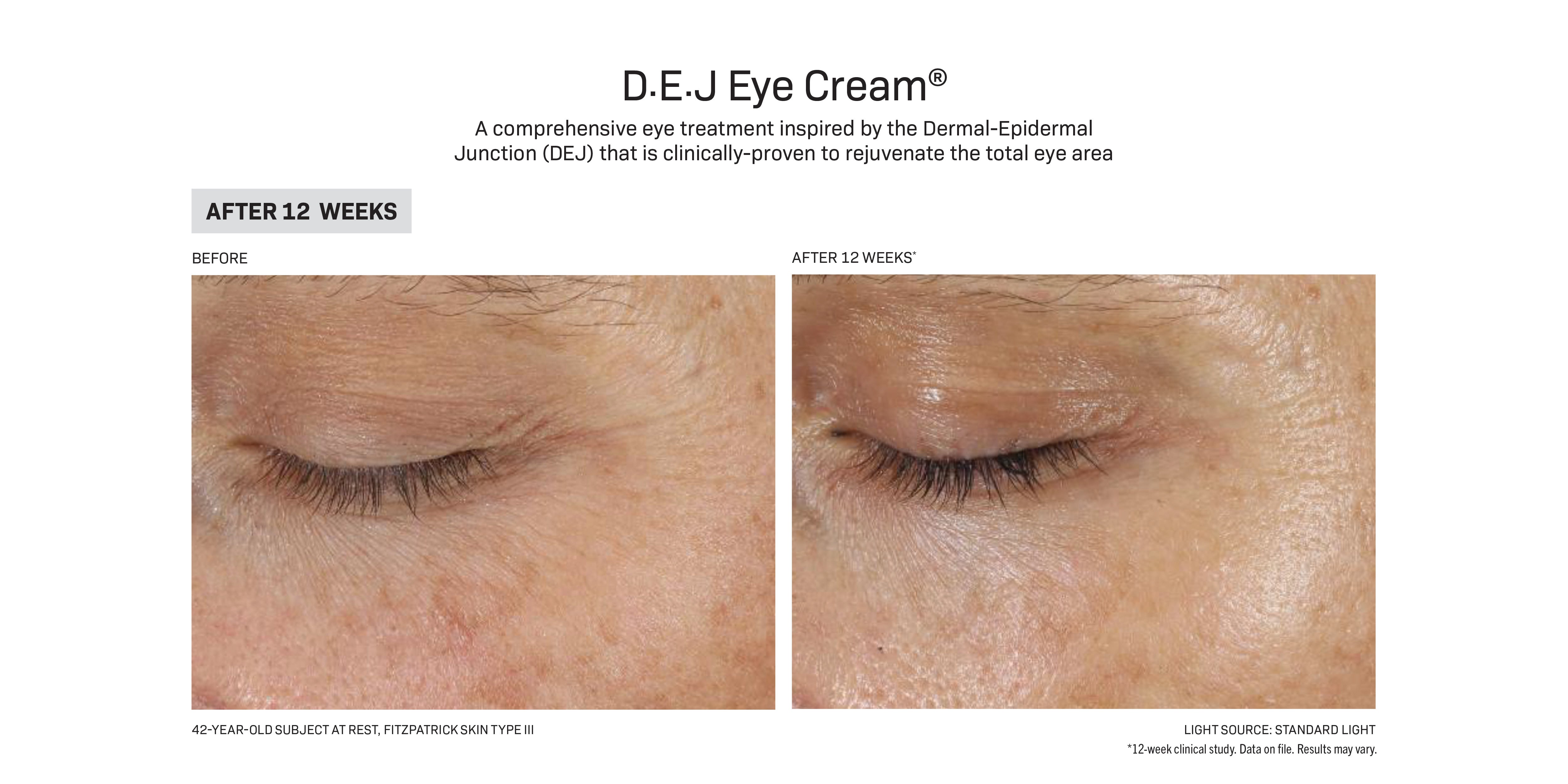 Revision Skincare D·E·J Eye Cream® (0.5 oz Pump)