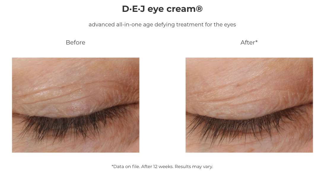 Revision Skincare D·E·J Eye Cream® (0.5 oz Pump)