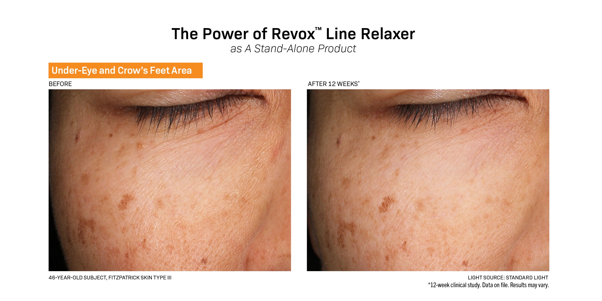 Revision Skincare Revox™ Line Relaxer (0.68 oz)