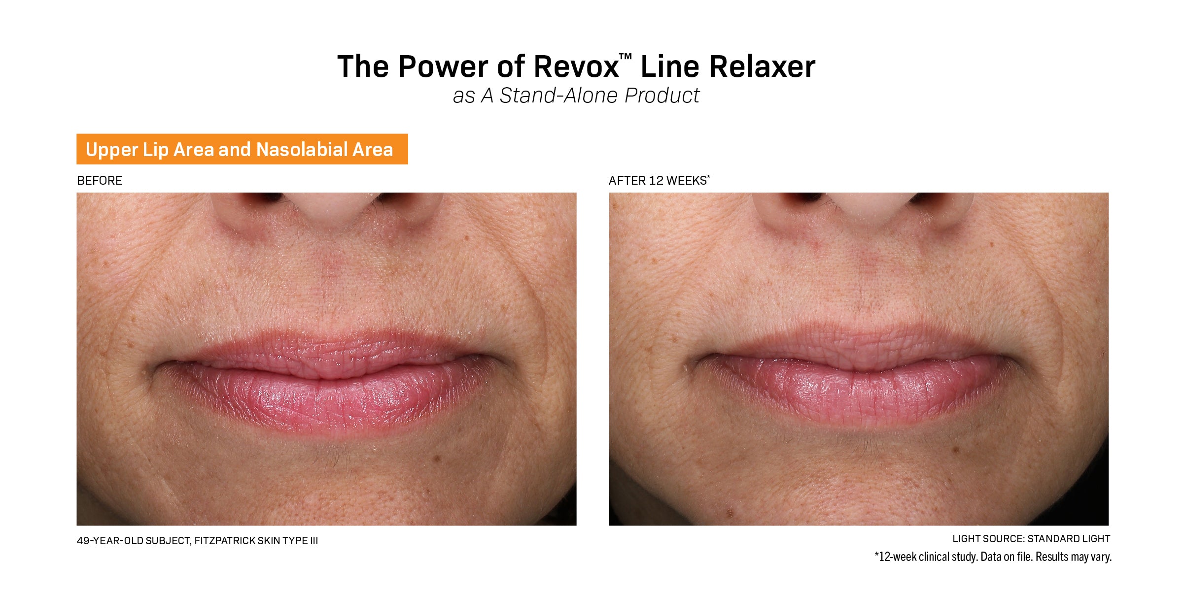 Revision Skincare Revox™ Line Relaxer (0.68 oz)