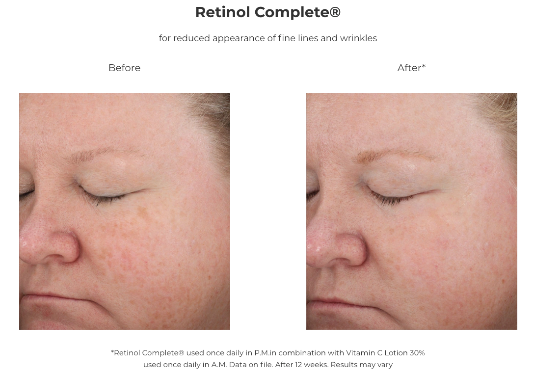 Revision Skincare Retinol Complete® 1.0 (1 oz)
