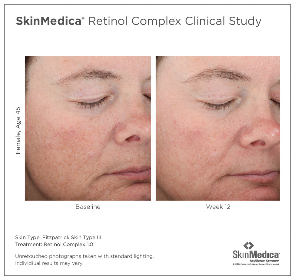 SkinMedica Retinol Complex 1.0 (1 oz)