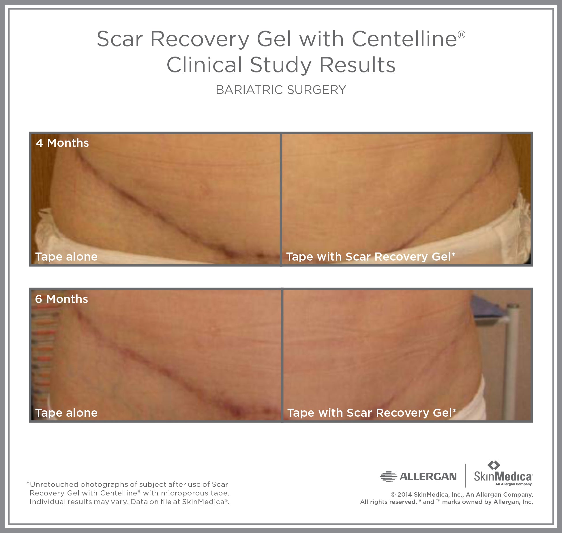 SkinMedica Scar Recovery Gel with Centelline (2 oz)