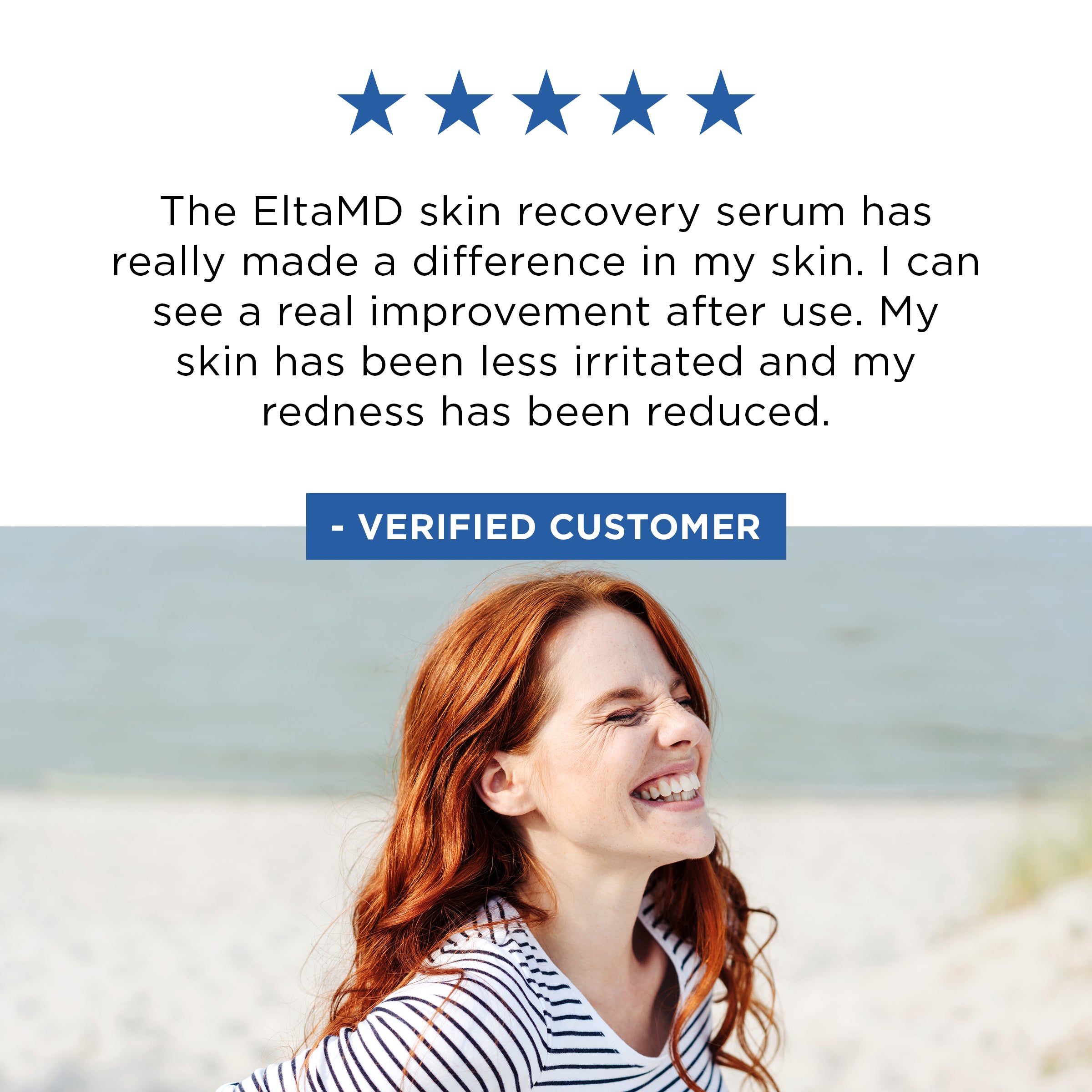 EltaMD Skin Recovery Serum (1 oz)