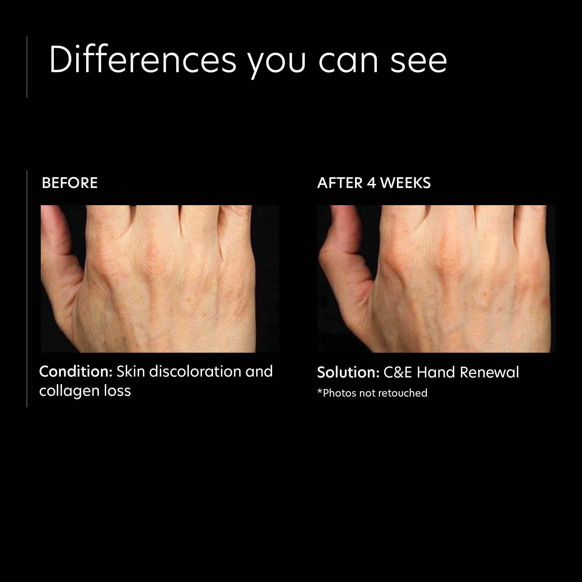 PCA Skin C&E Hand Renewal (1 oz)
