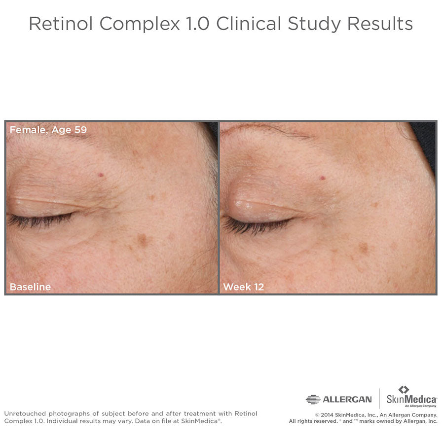SkinMedica Retinol Complex 1.0 Results Before and After