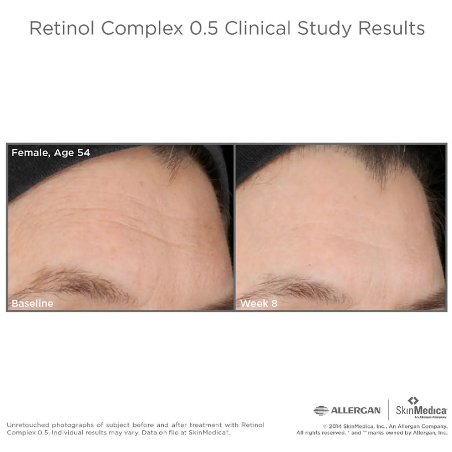 SkinMedica Retinol Complex 0.5 Before and After
