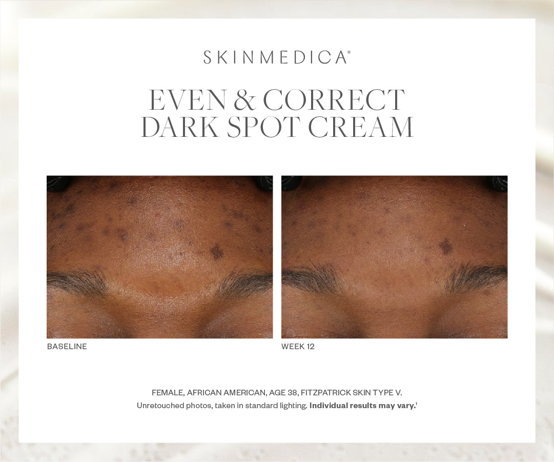 SkinMedica Even & Correct Dark Spot Cream (0.5 oz)