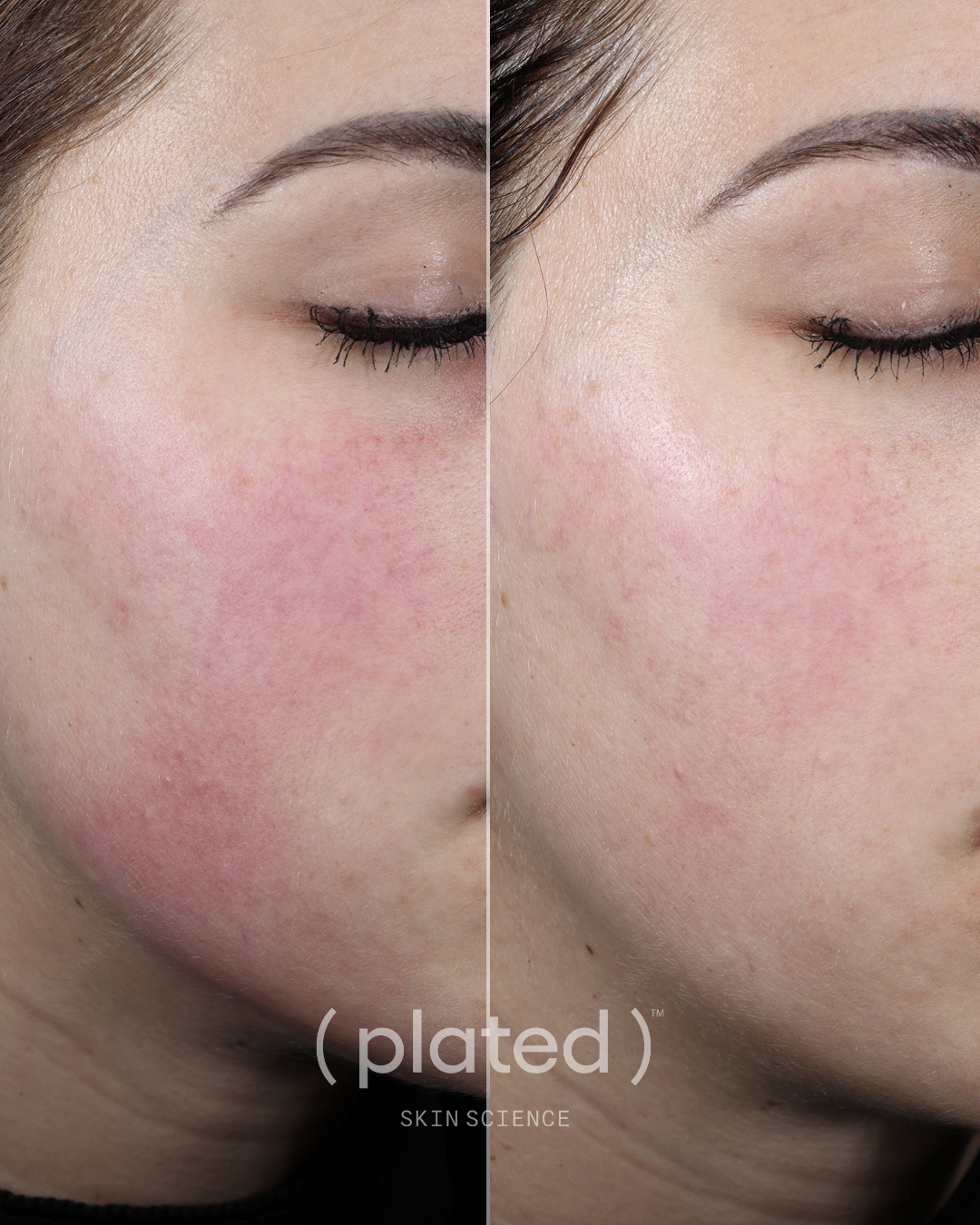 Plated Skin Science DAILY Serum (1 oz)