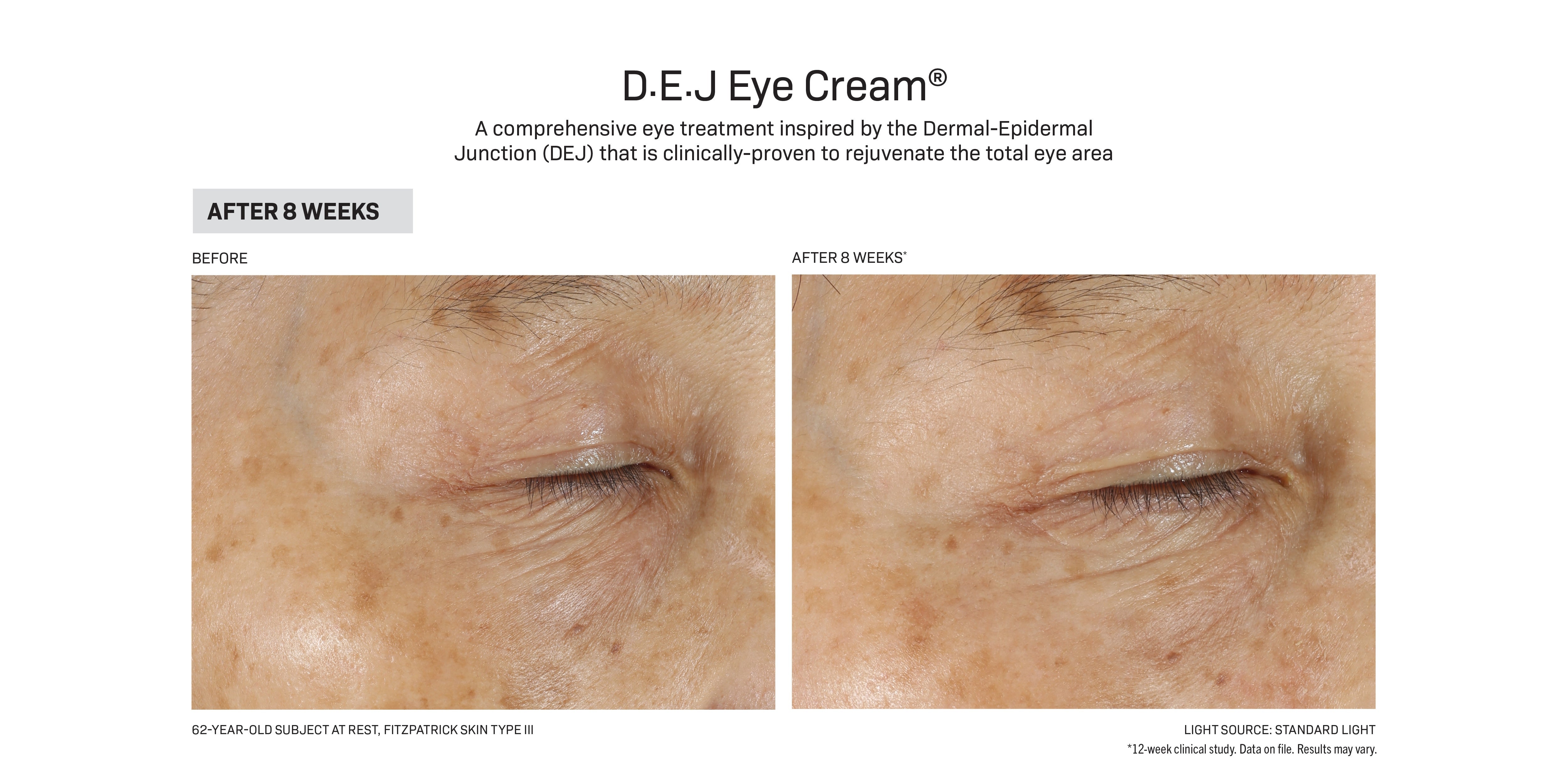 Revision Skincare D·E·J Eye Cream® (0.5 oz Pump)