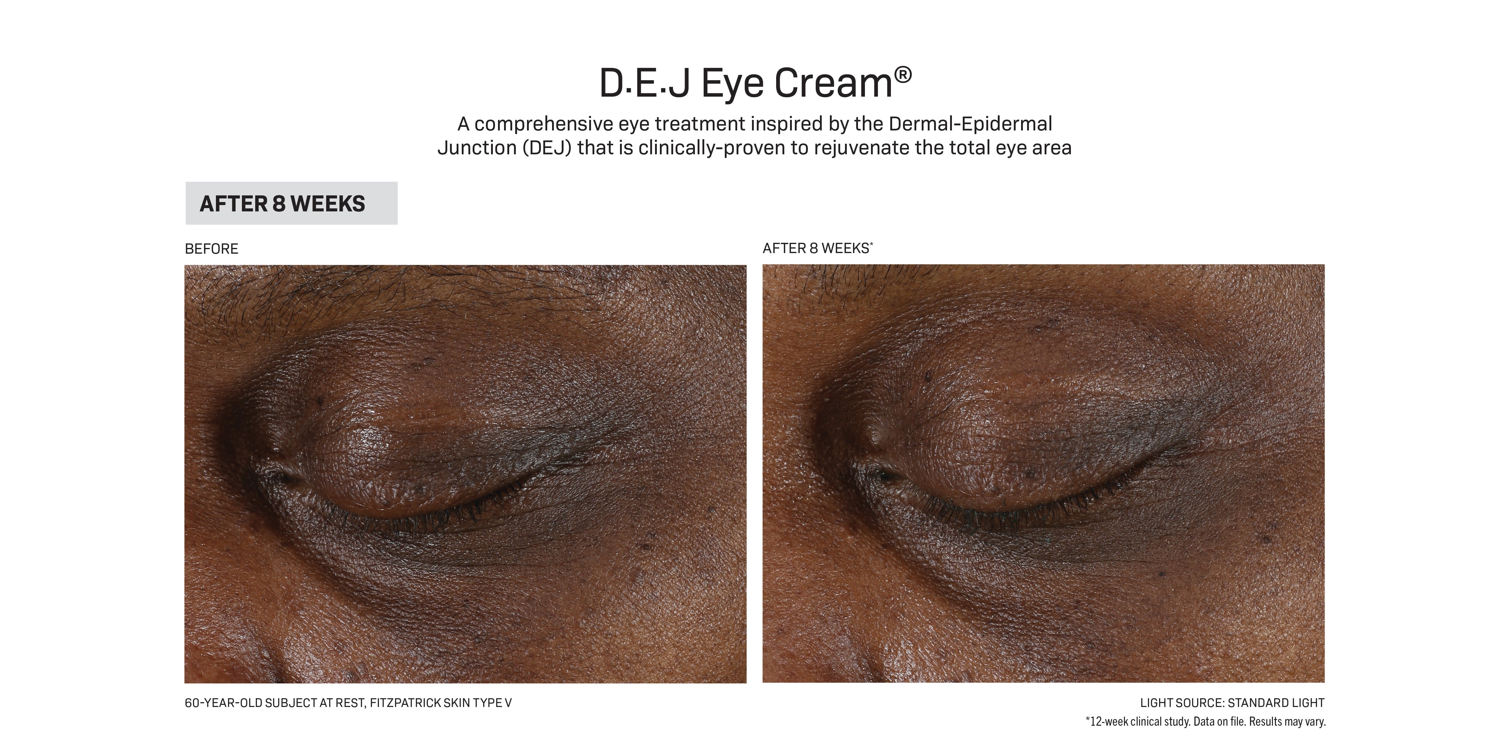 Revision Skincare D·E·J Eye Cream® (0.5 oz Pump)