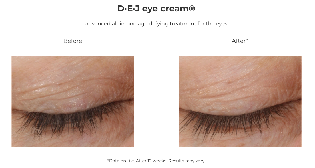 Revision Skincare D·E·J Eye Cream® (0.5 oz)