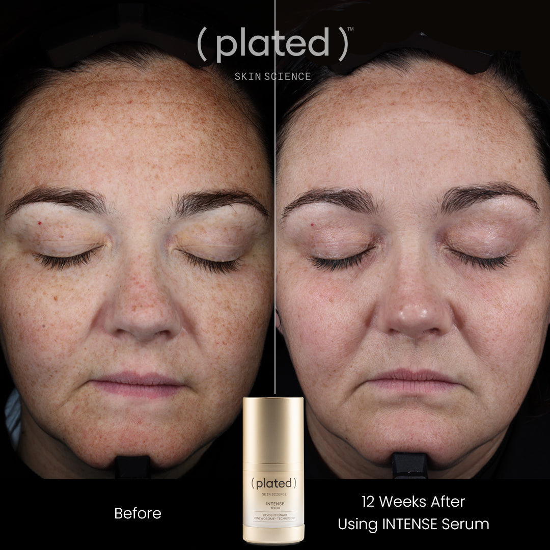 Plated Skin Science INTENSE Serum (0.5 oz)