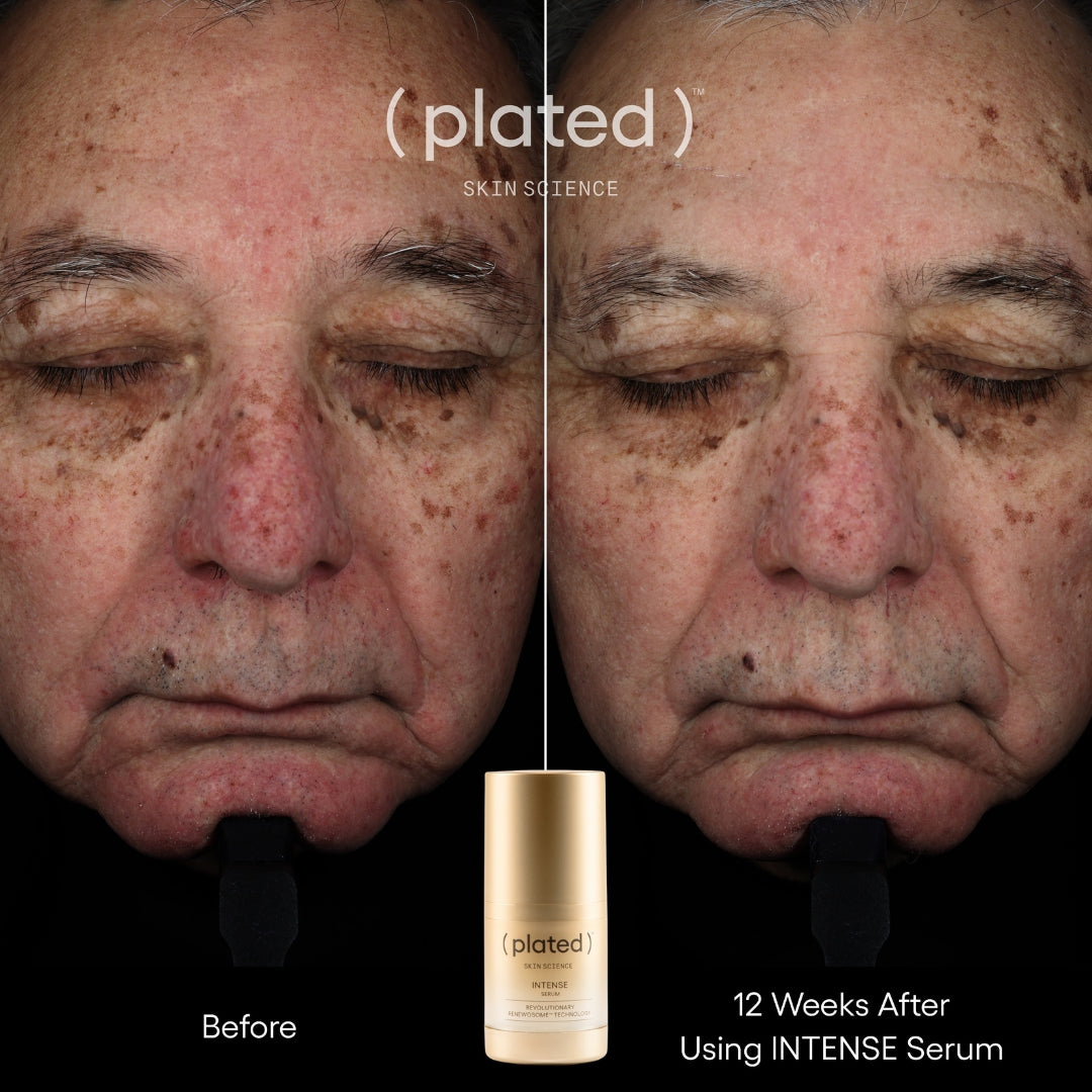 Plated Skin Science INTENSE Serum (0.5 oz)