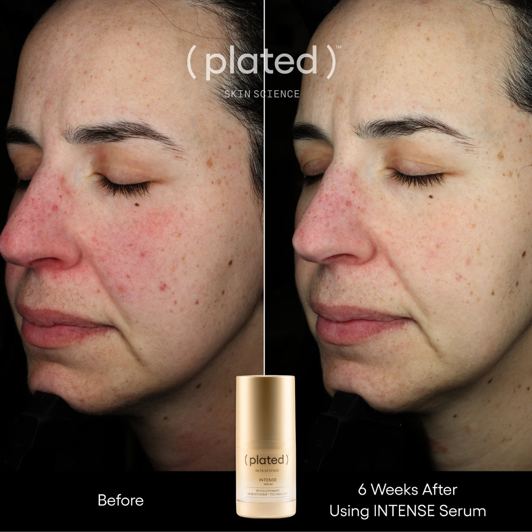 Plated Skin Science INTENSE Serum (0.5 oz)