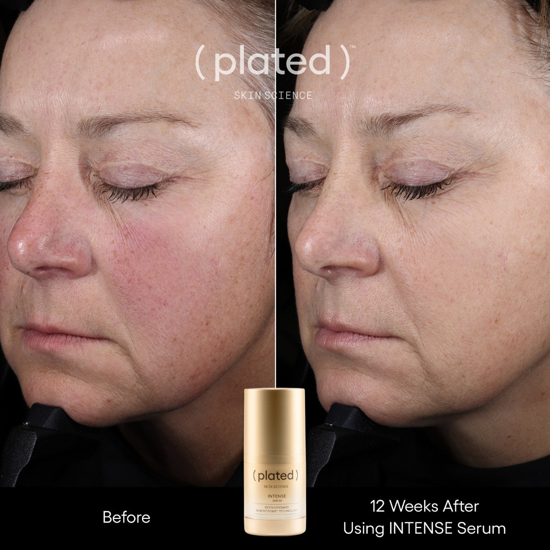 Plated Skin Science INTENSE Serum (0.5 oz)