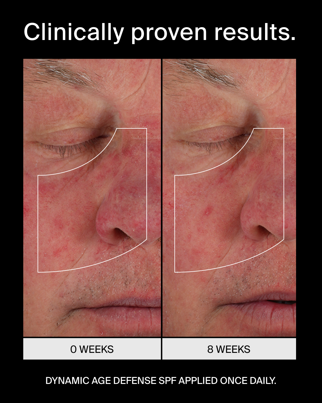 Pavise Dynamic Age Defense SPF 30 Refill (1 oz)