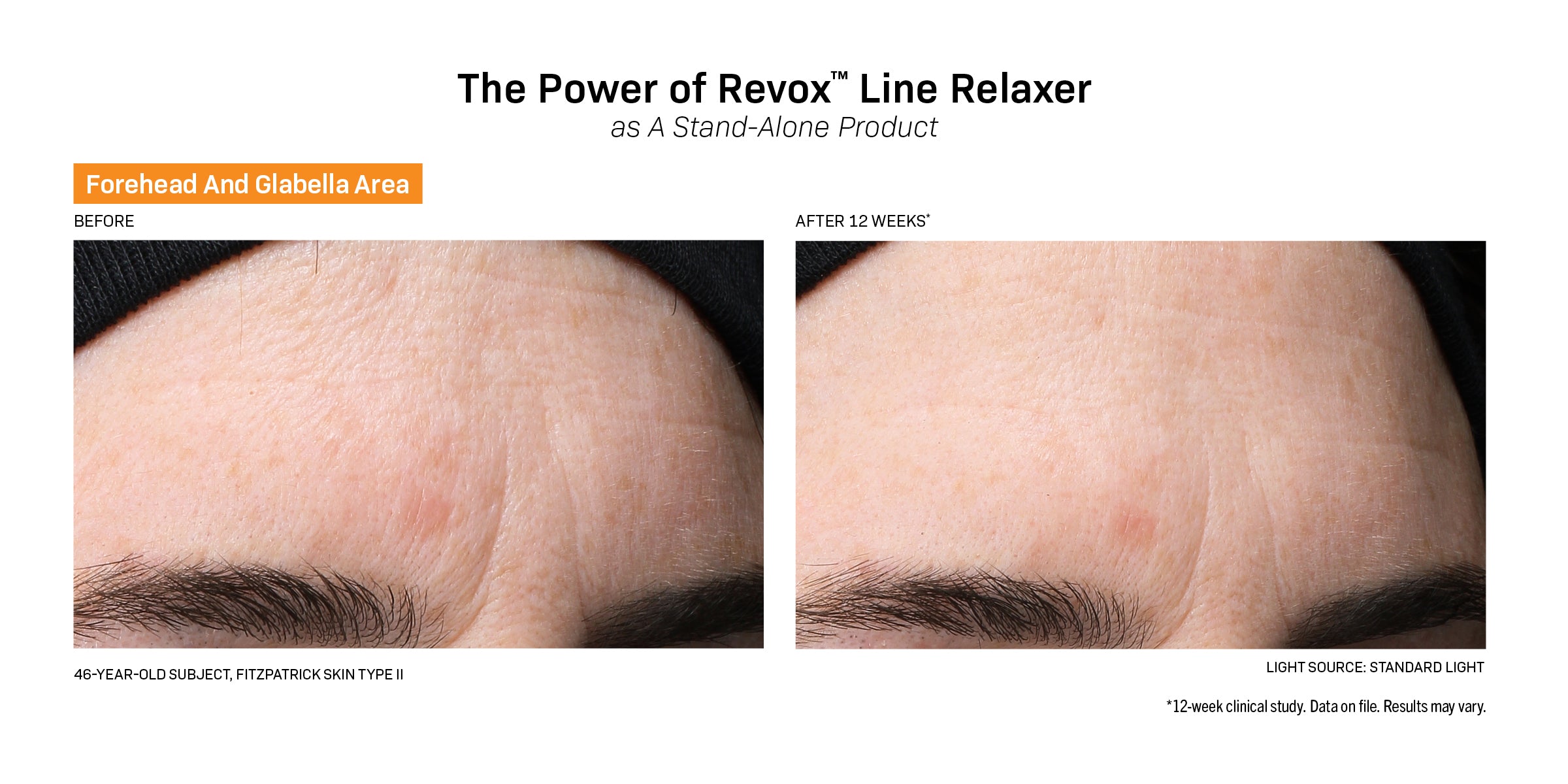 Revision Skincare Revox™ Line Relaxer (0.68 oz)