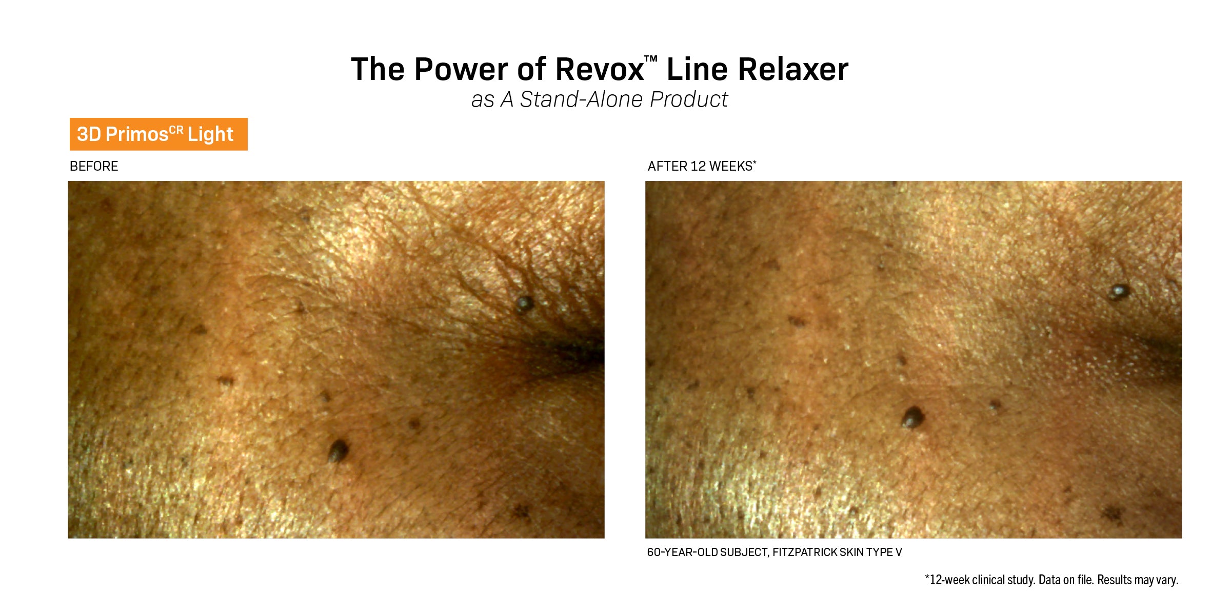 Revision Skincare Revox™ Line Relaxer (0.68 oz)