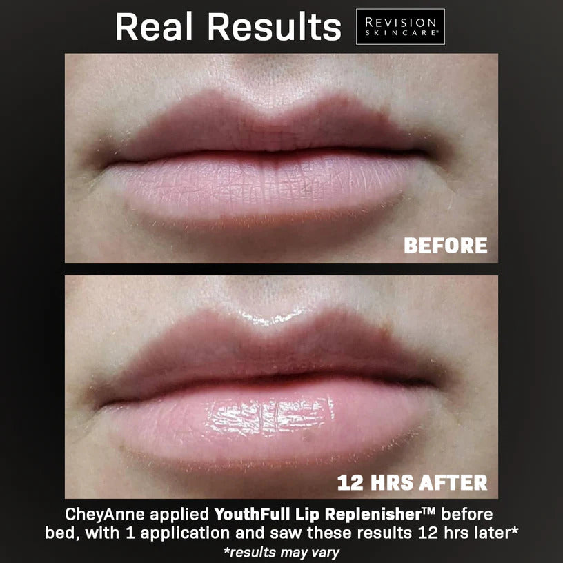 Revision Skincare YouthFull Lip Replenisher® 0.33 oz