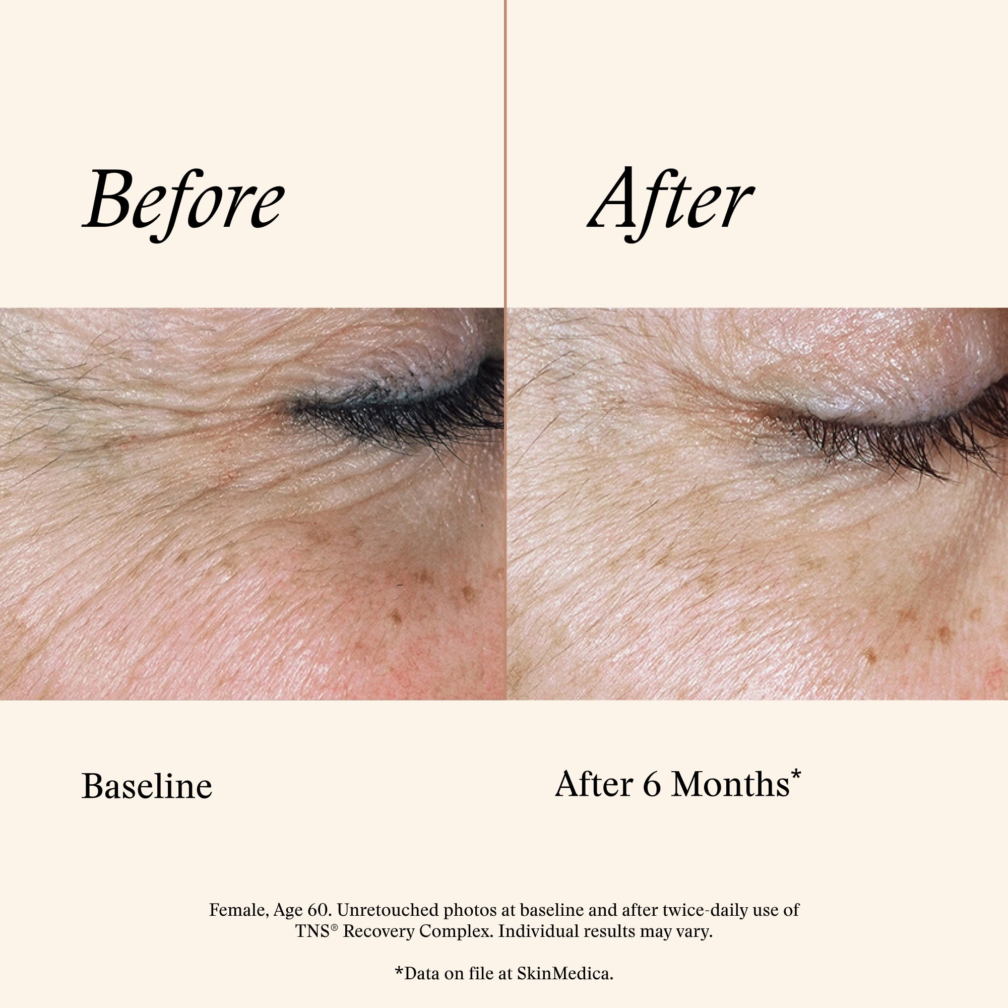 SkinMedica TNS Recovery Complex (1 oz)