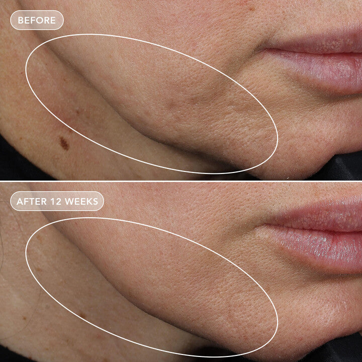 IMAGE Skincare VOL.U.LIFT GLP-1 4D Skin Rebound Complex (2 oz)