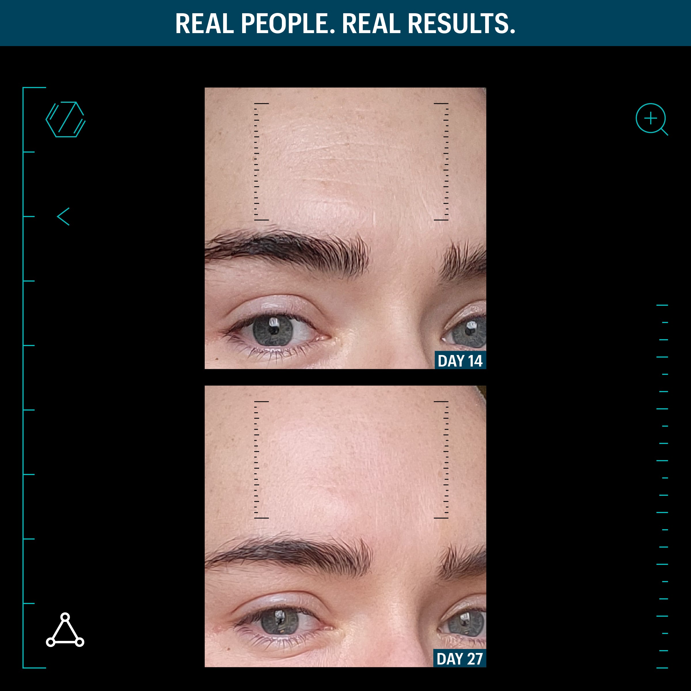 Allies of Skin Multi Peptides and Growth Factor Advanced Lifting Serum (1 oz)