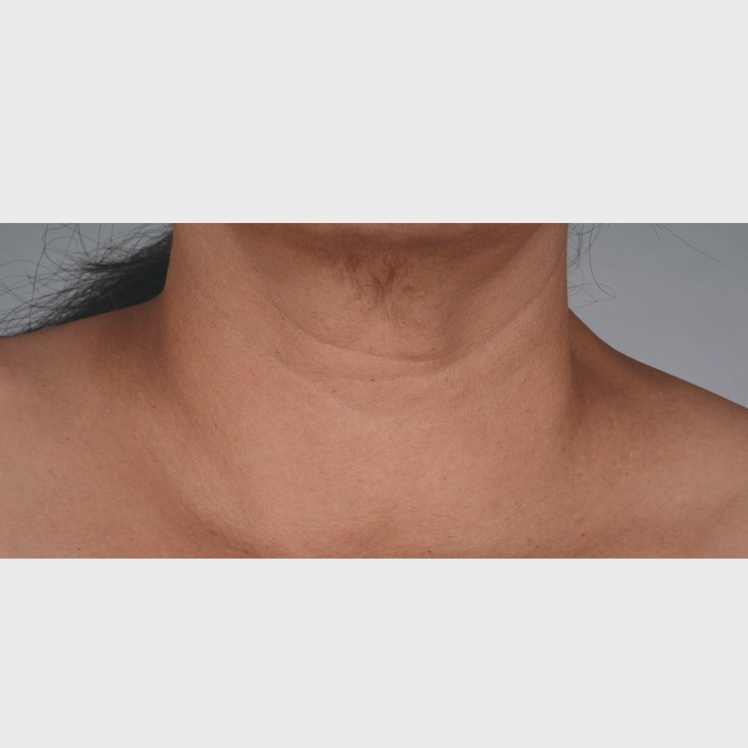 iS Clinical NeckPerfect Complex (1.7 oz)