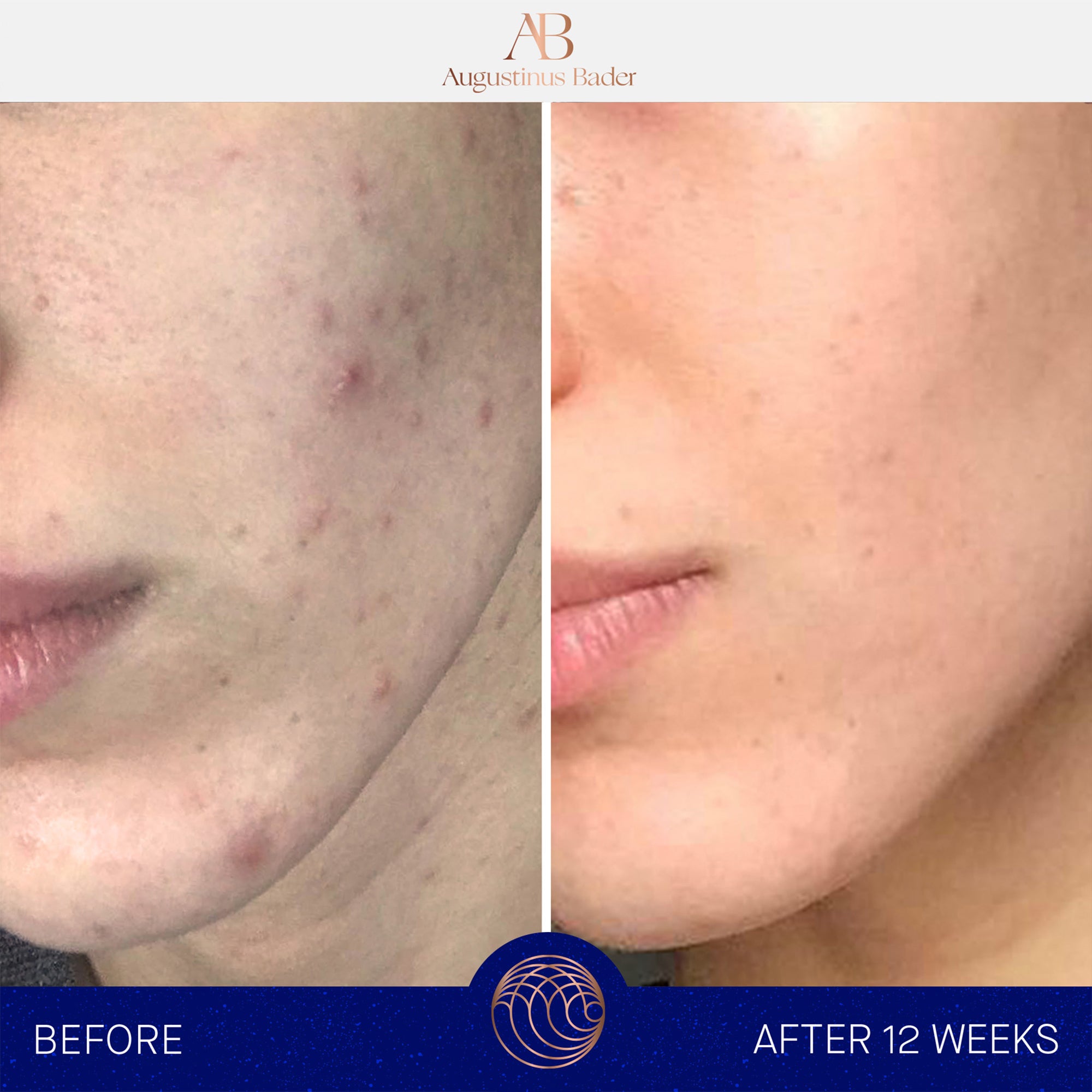 Augustinus Bader The Cream (1.7 oz)